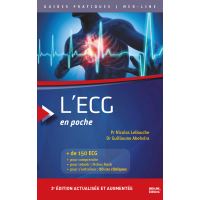 découvrez notre guide complet sur l'ecg pour débutants, qui vous aidera à comprendre les bases de l'électrocardiogramme, interpréter les résultats et appliquer vos connaissances dans un contexte clinique. idéal pour les étudiants et professionnels de la santé souhaitant approfondir leurs compétences en cardiologie.